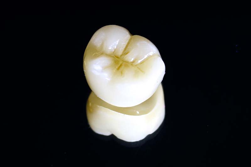 ジルコニアの人工歯