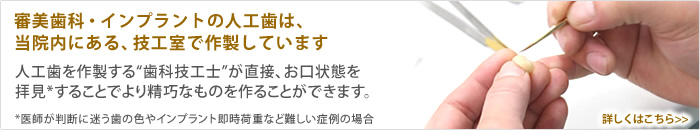 審美歯科・インプラントの人工歯は当医院で作成しています