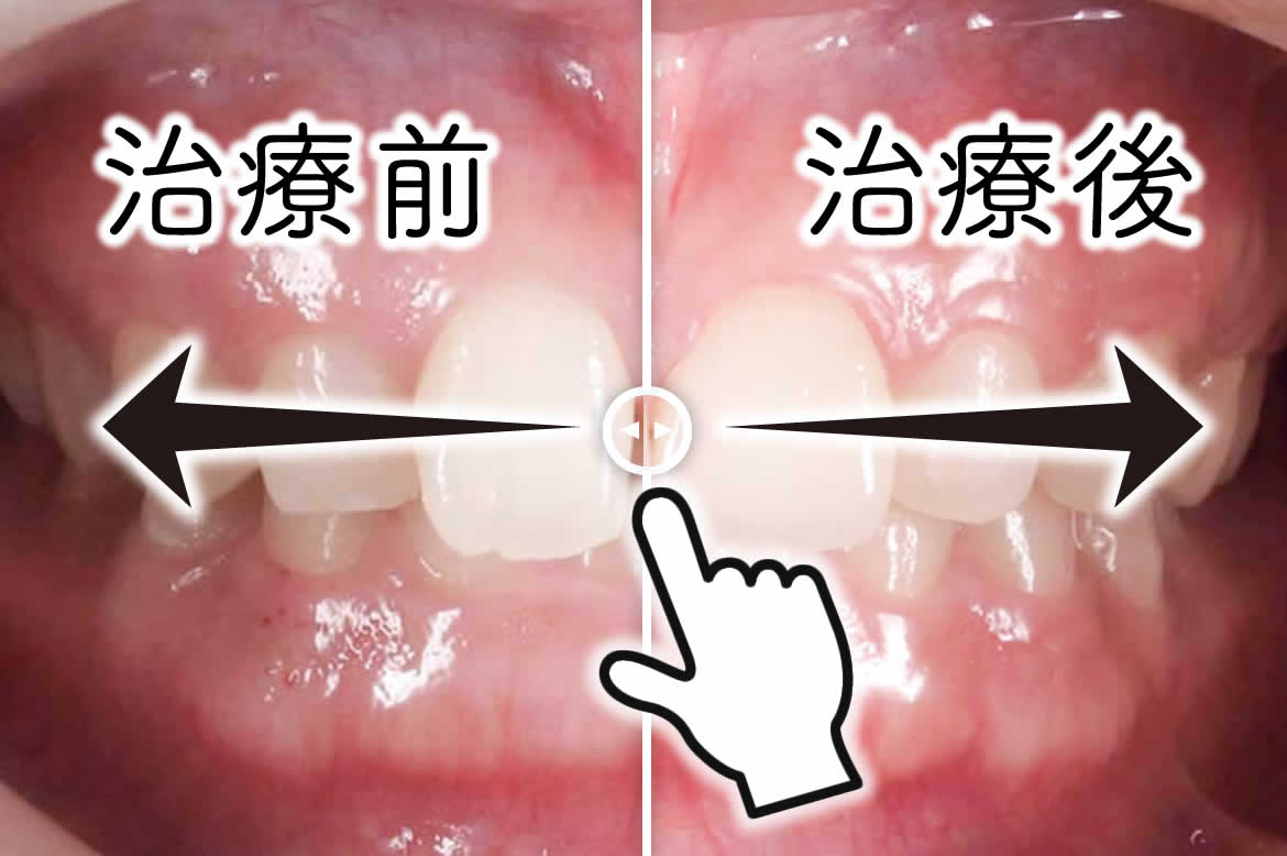 画像の操作方法