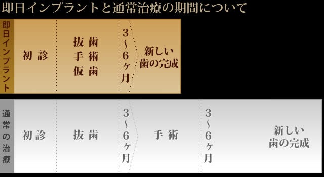 即日インプラントと通常治療の期間について